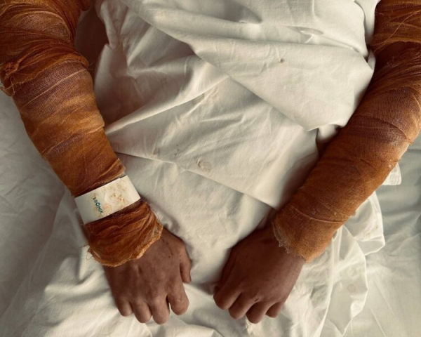 В Казани двое мужчин получили ожоги в общественной бане