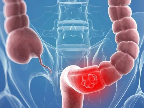 Эпидемия 30-летних: врачи бьют тревогу из-за страшного диагноза