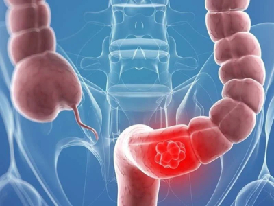 Эпидемия 30-летних: врачи бьют тревогу из-за страшного диагноза